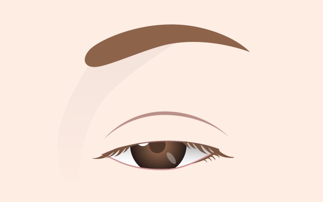 Normal eyelid opening