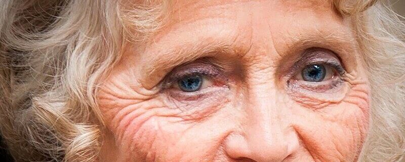 Illustration of wrinkle causes
