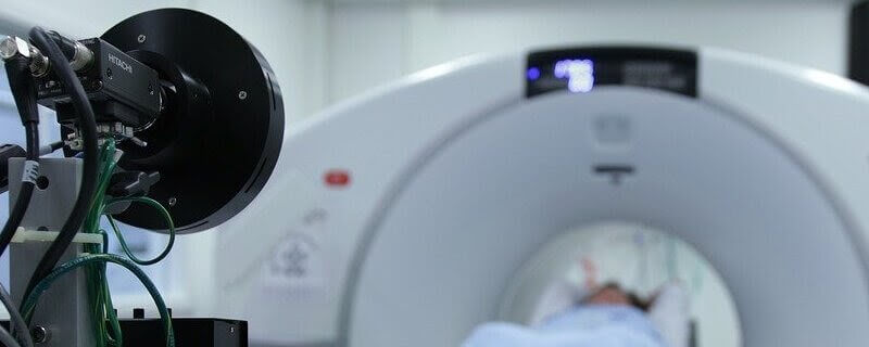 CT and MRI imaging used for diagnosing calcifying epithelioma