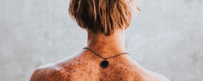Diagram illustrating the size-based classification of skin tags: acrochordon, skin tag, and pedunculated fibroma